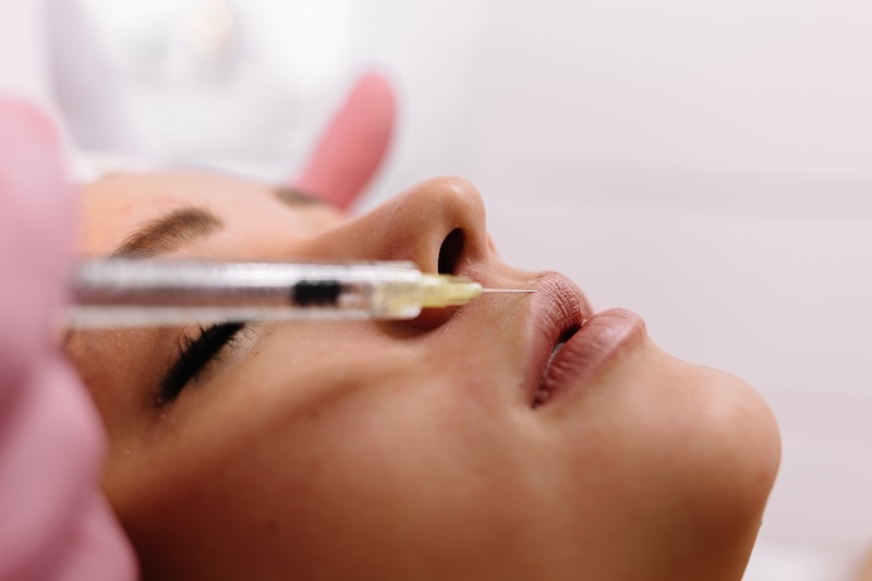 Fillers: den kompletta guiden till behandlingen